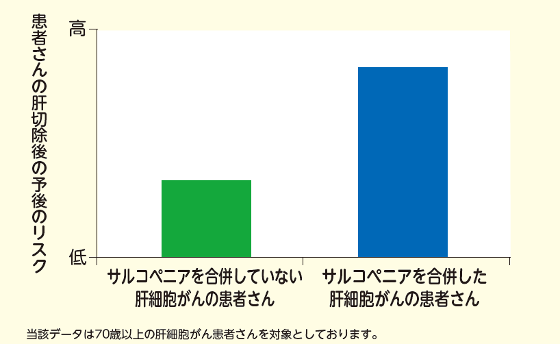 サルコペニアを合併した肝細胞がんの患者さんにおける肝切除後の予後のリスクのイメージ図