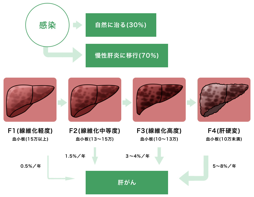 線維症と肝硬変の合併症にはどのようなものがありますか?