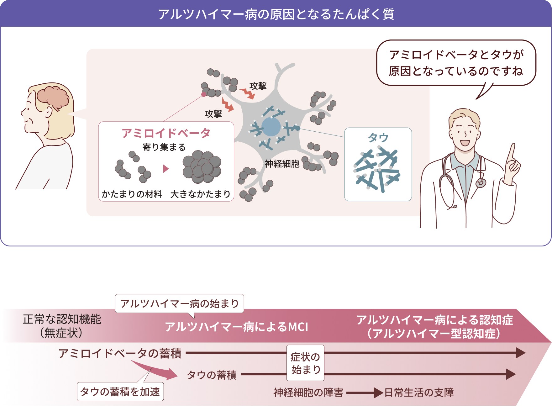 アルツハイマー病の原因となるたんぱく質