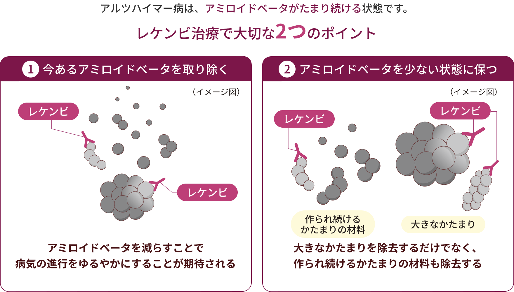 レケンビ治療で大切な2つのポイント
