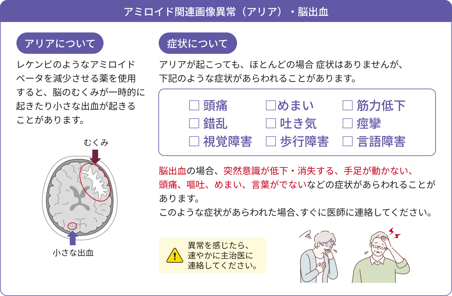 アミロイド関連画像異常（アリア）と脳出血についての説明と起こりうる症状